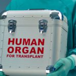 organ donation PGI