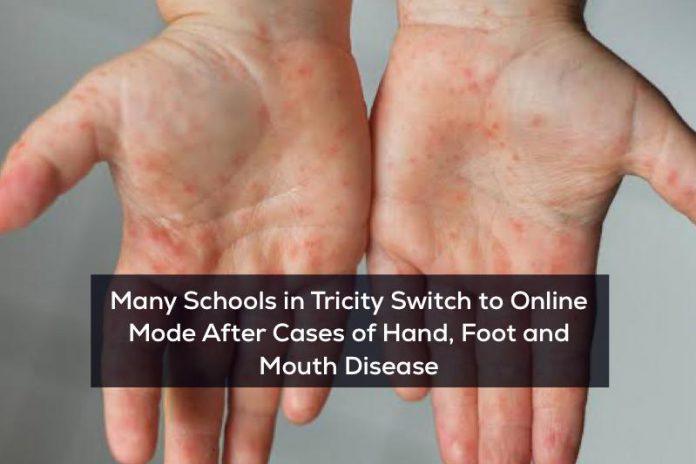 Hand foot mouth disease chandigarh
